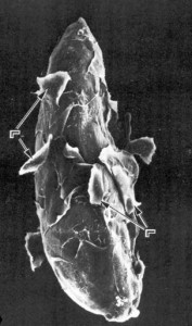 Drosophila immune reaction against a parasitoid egg